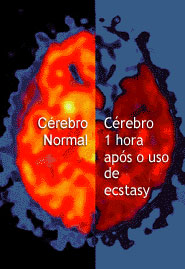 Efeitos do Ecstasy